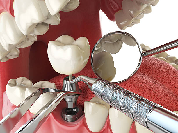 Best Emergency Dental Services for Seniors in Helena Flats, MT